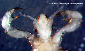 Abbildung 2: Mit den zu Greifzangen abgewandelten Fußgliedern kann sich die Kleiderlaus (Pediculus humanus) an der Körperbehaarung des Menschen festhalten